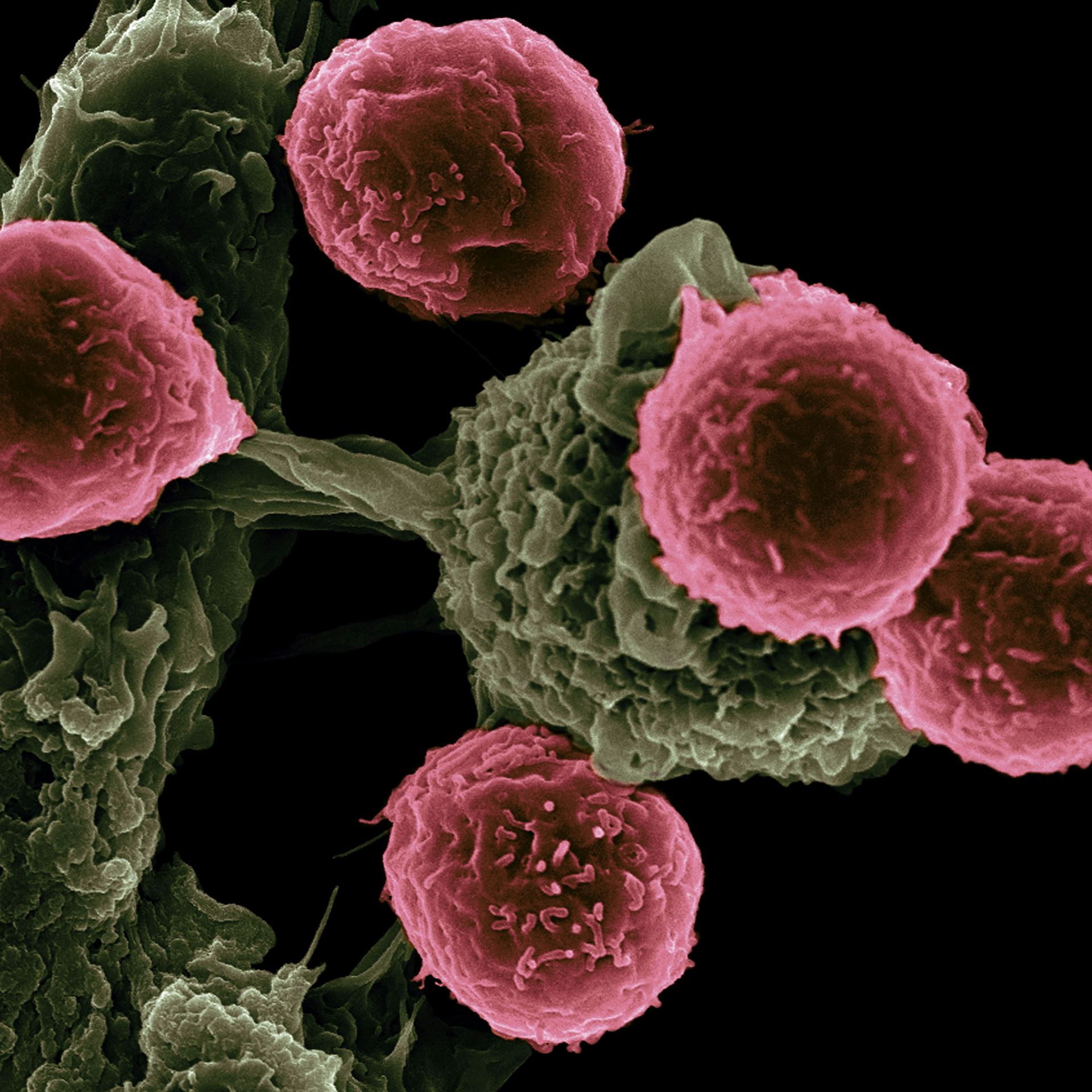 cancer cell